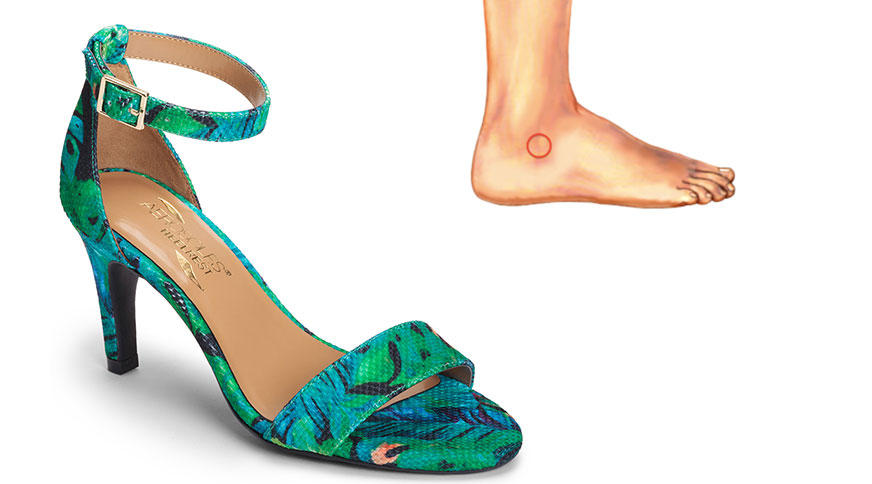 سینوس تارسی