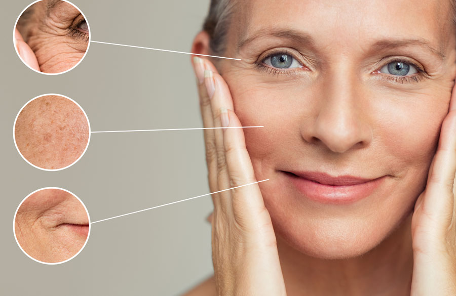 کارایی میکرودرم