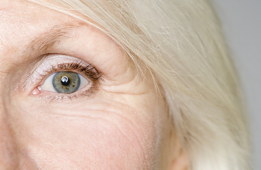 نکات مهم برای مبارزه با چینوچروک