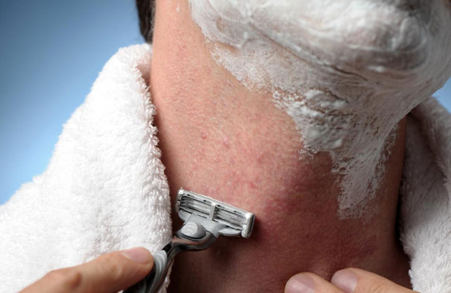 التهاب پس از اصلاح