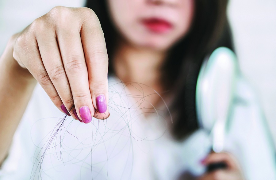 روشهای طبیعی برای کاهش ریزش مو