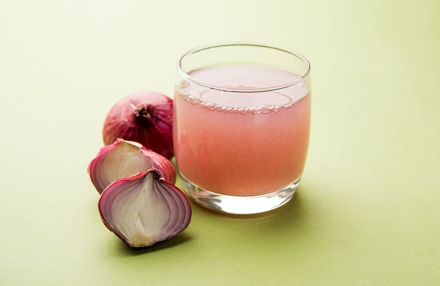 آب پیاز برای برداشتن خال