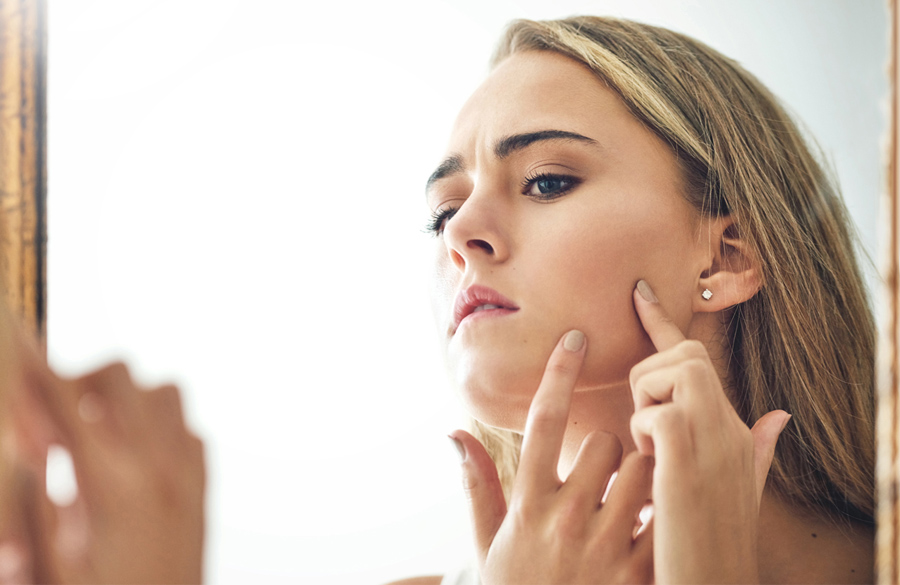 ورزش و جوش صورت