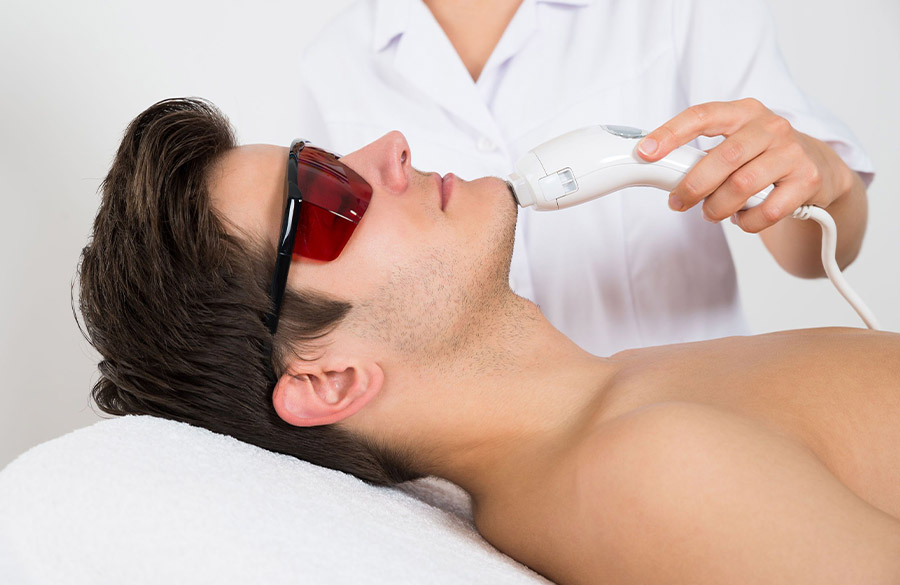 لیزر موی زائد