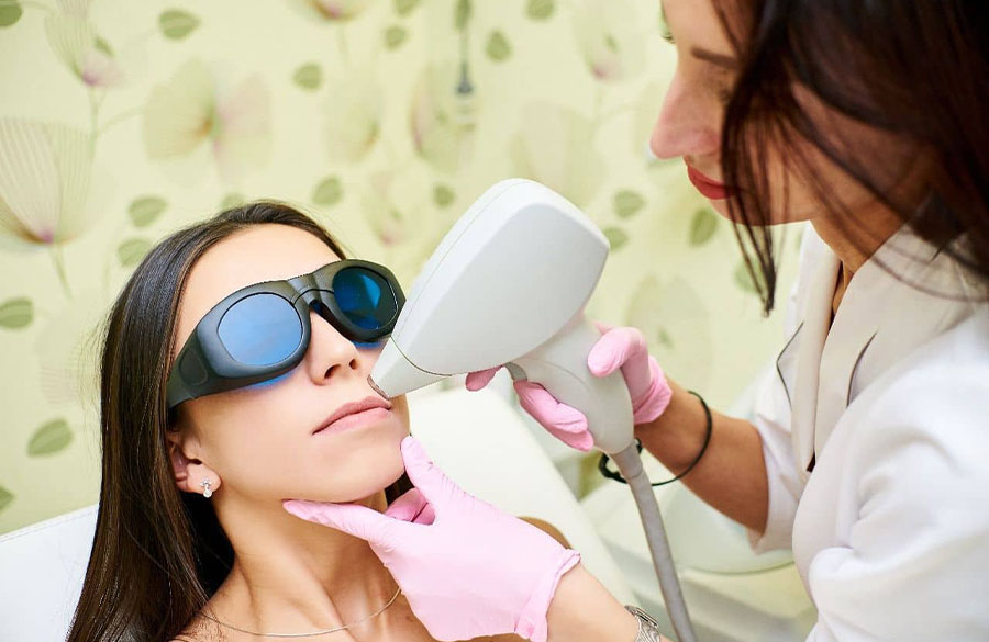 لیزر موی بالای لب