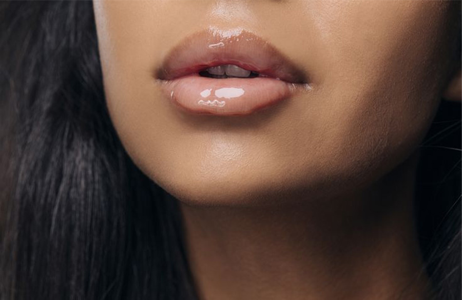 برق لب نچرال