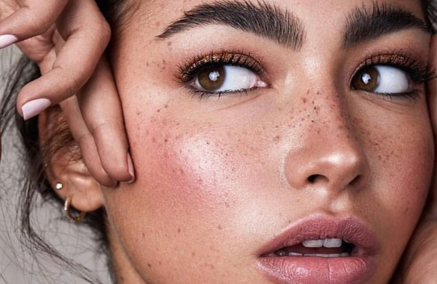 آرایش کک و مکدار