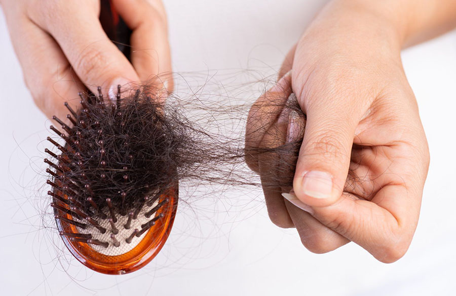 ریزش مو در زنان