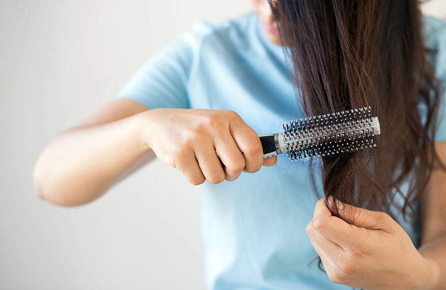 ریزش مو در زنان