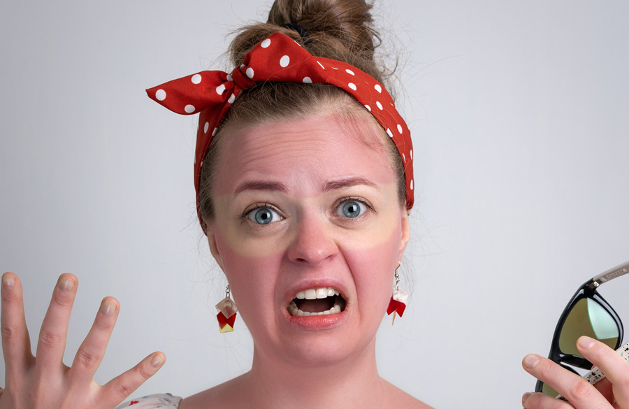 سوختگی در نور خورشید