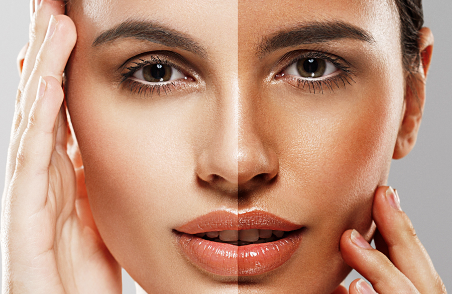 برنزه شدن با نور خورشید