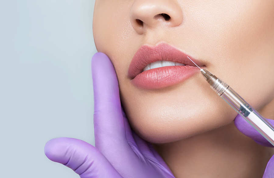 حجم دادن به لب ها با فیلر