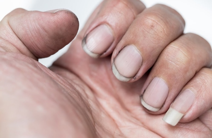 تمیز کردن ناخنها راهی برای افزایش جذابیت آقایان